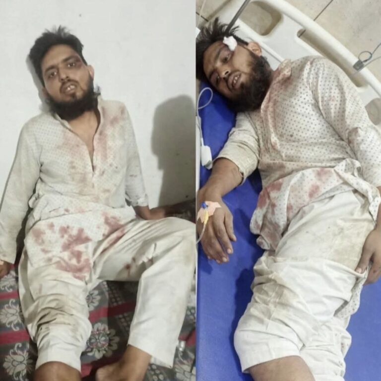 घाट पर दोस्तों संग बैठे युवक पर नाम पूछकर लाठी-डंडों से हमला, जातिसूचक गालियों के बाद पीट-पीटकर किया घायल, मामला सोशल मीडिया पर वायरल